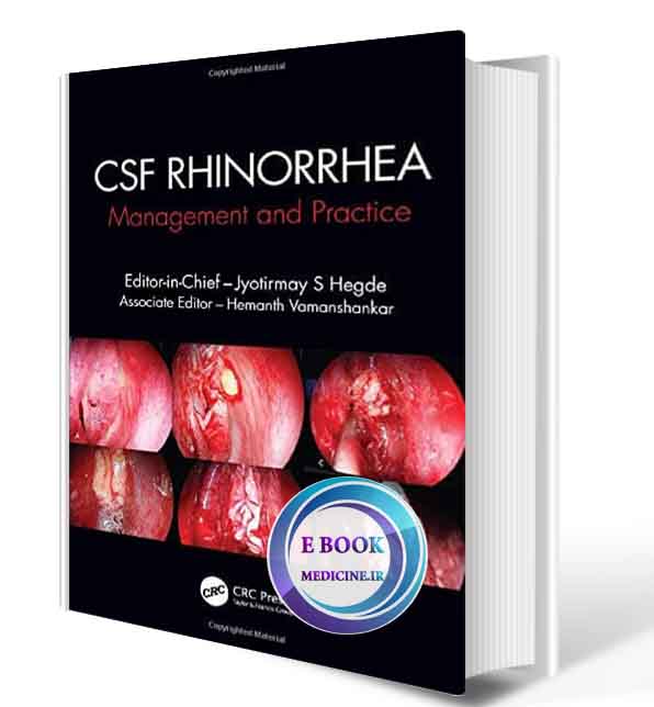 دانلود کتاب CSF Rhinorrhoea: Management and Practice 2020 (ORIGINAL PDF)